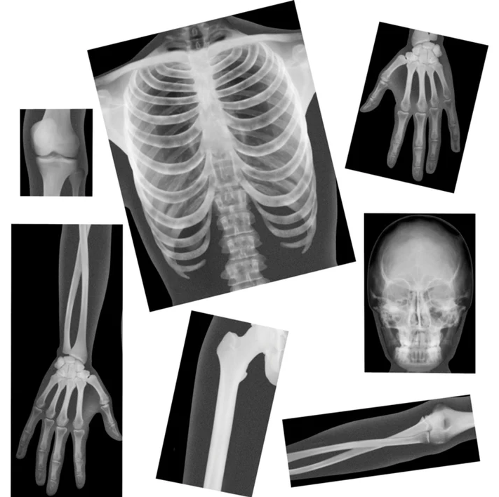 Image Radiographies humaines à agencer